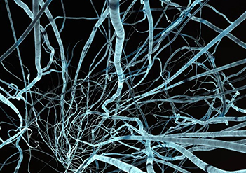 掃描電鏡在碳納米纖維上的應(yīng)用